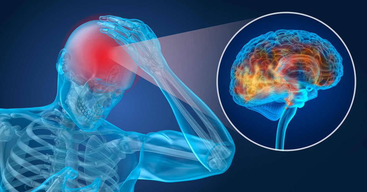 What Is Post Concussion Syndrome Traumatic Brain Injury what-is-post-concussion-syndrome-traumatic-brain-injury