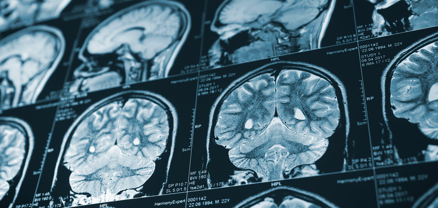 Traumatic Brain Injury Lawyer Nashville TN Traumatic Brain Injury Lawyer Nashville TN