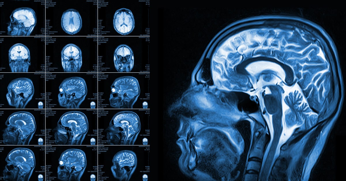 Anoxic Brain Injury - TBI Lawyer Nashville Anoxic Brain Injury - TBI Lawyer Nashville