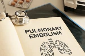 When a Car Accident Leads to a Pulmonary Embolism