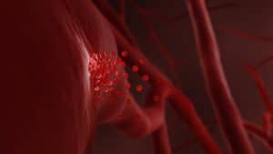 Internal Bleeding: a Deadly Injury That Often Remains Hidden